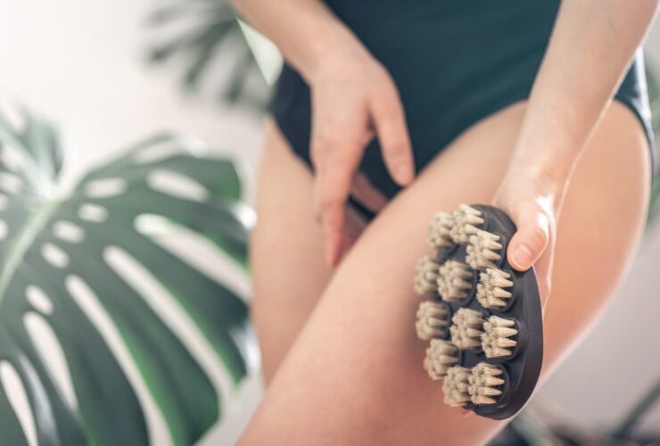perdu cellulite