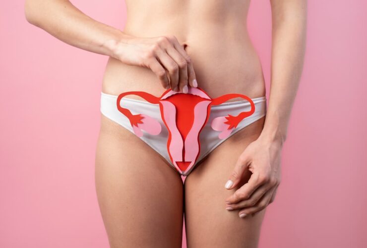 vaginoplastie