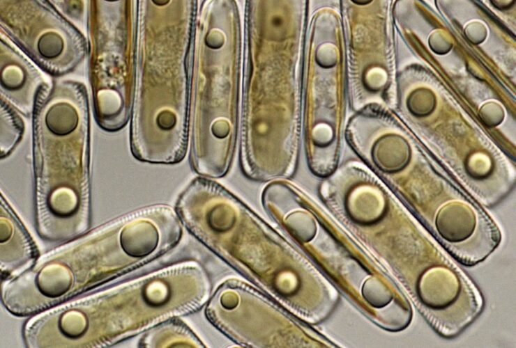 tératome