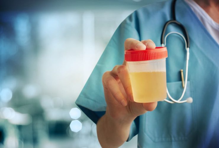 urine fluo
