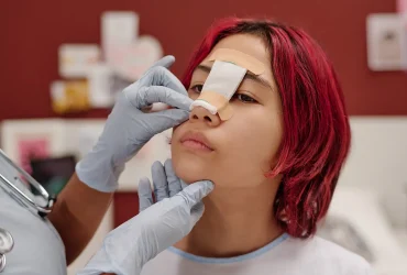rhinoplastie