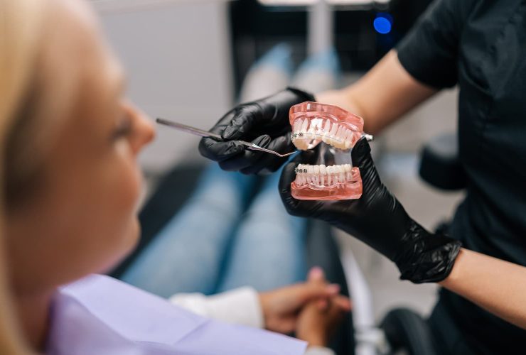 orthodontie adulte