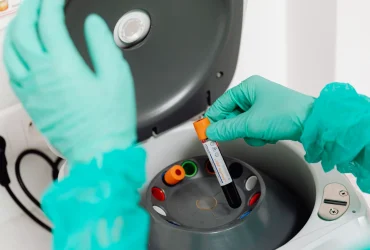 Échantillon sanguin manipulé en laboratoire pour une analyse de bilirubine